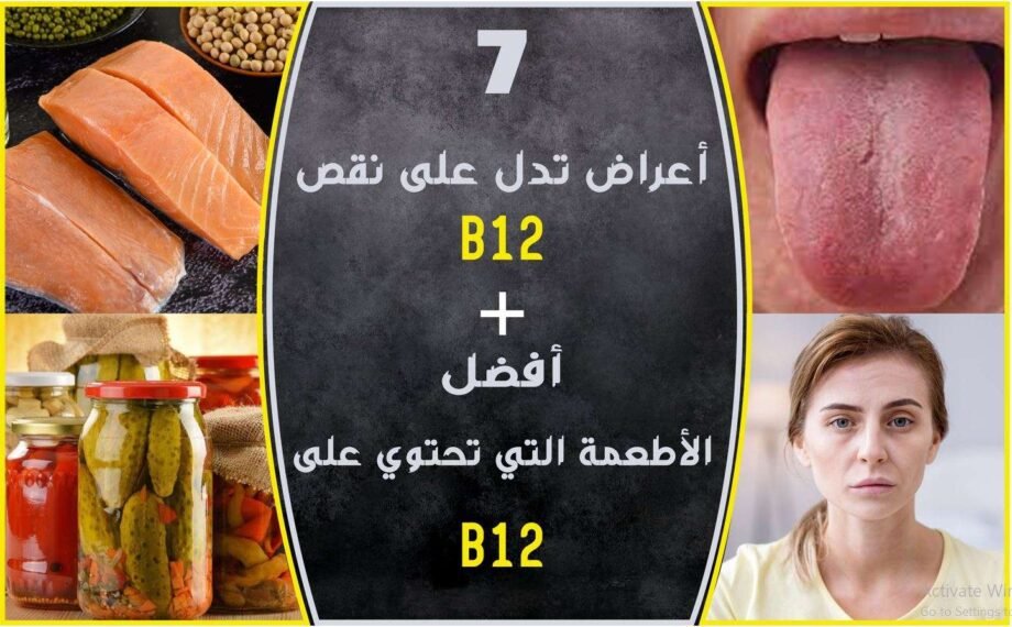 7 علامات تدل على نقص فيتامين B12 وأفضل الأطعمة التي يمكنك تناولها للوقاية من ذلك